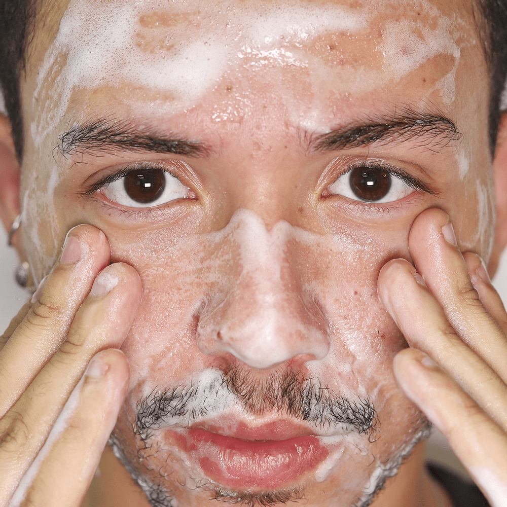 Smart Hyaluclar Foam - Espuma de Limpeza Clareadora - 150 ml - Smart GR- 3